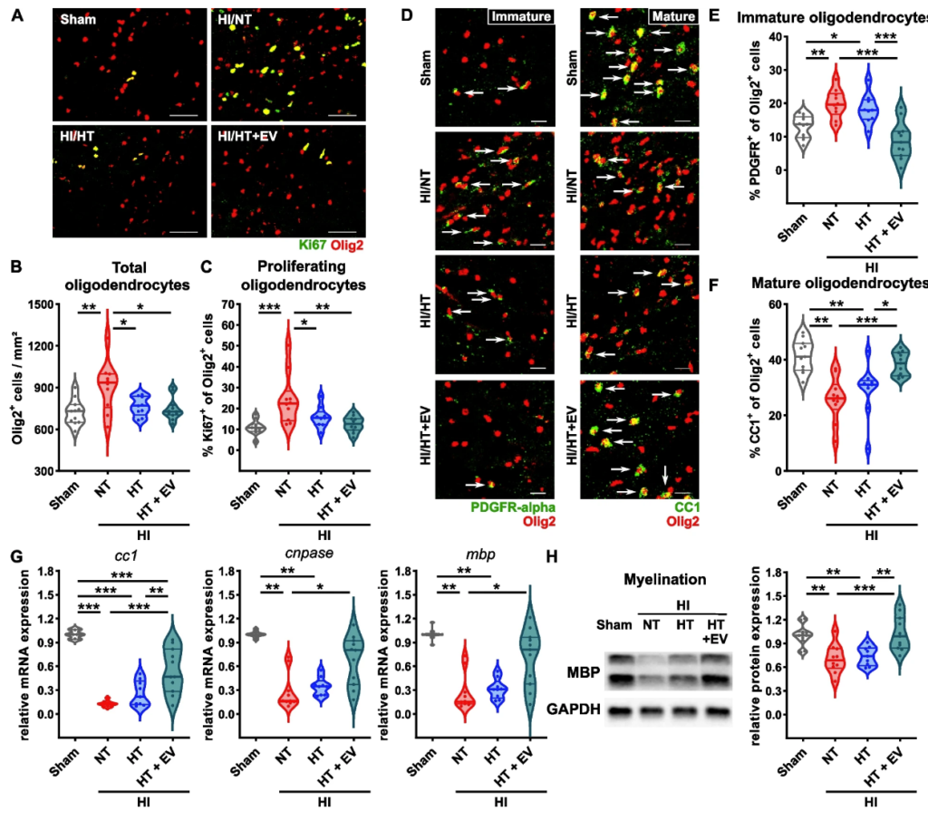 Intranasal ciMSC-EV delivery overcomes limitations of HT on HI-induced impaired oligodendrocyte maturation and myelination