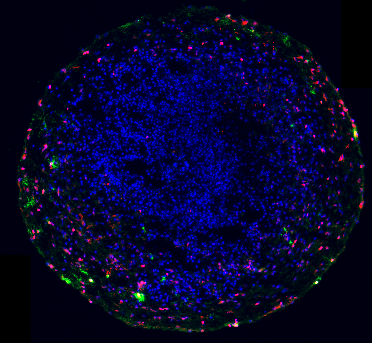 Cortical brain organoid