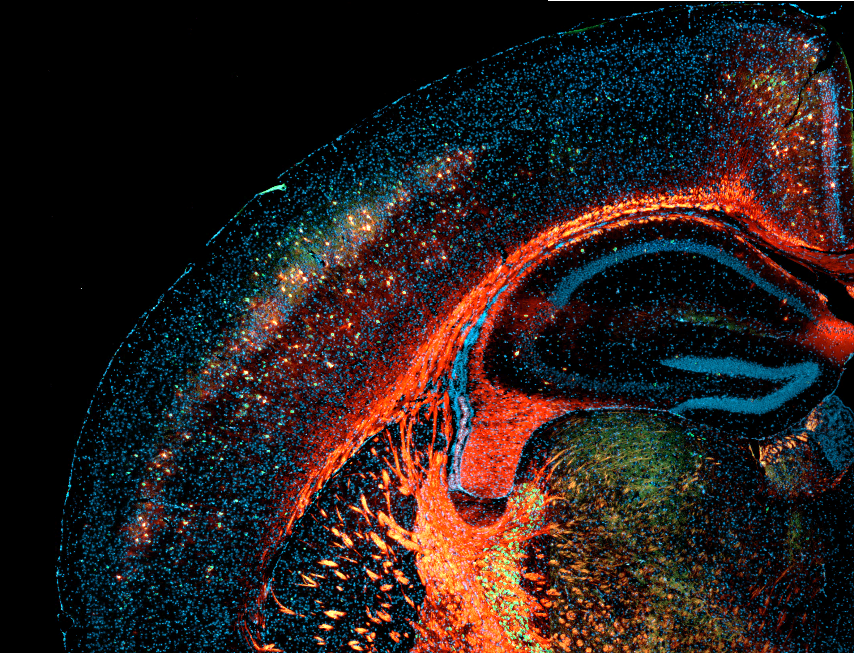 Cortex and hippocampus of the rat brain stained in red with N-acetylgalactosamine-binding Wisteria floribunda agglutinin (WFA*) to visualize perineural nets (and myelin aspecficially lights up) and in green for parvalbumin-positive interneurons. Counterstain of all cell nuclei with DAPI in blue.