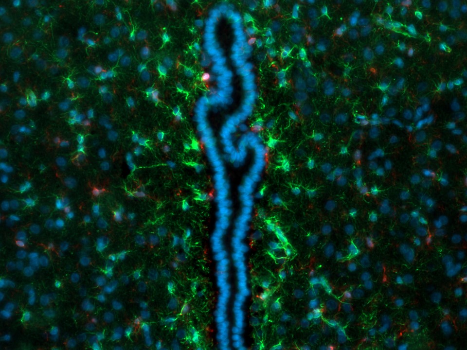 Microglial cells (red) and astrocytes (green) located at the third ventricle in the rat brain. All cell nuclei are counterstained with DAPI (blue).