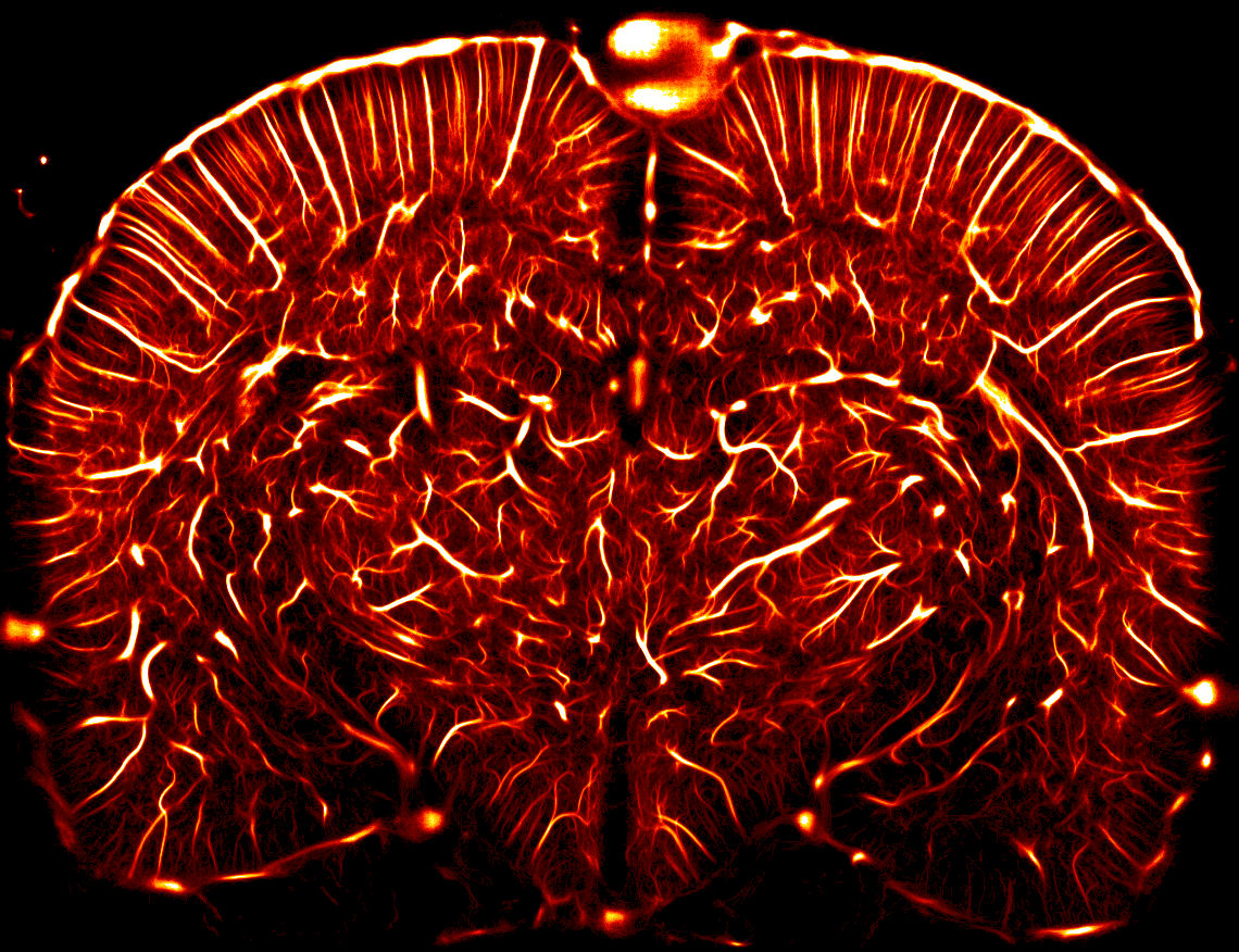 Vascular density of a complete coronal section of the living rat brain