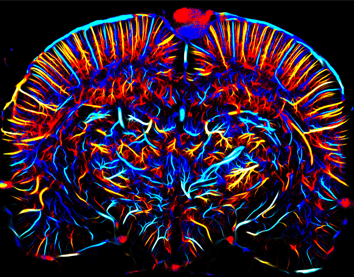 The axial velocities of the gas microbubbles (measured in the mm/s range) and their direction (blue = upward flow, red = downward flow)