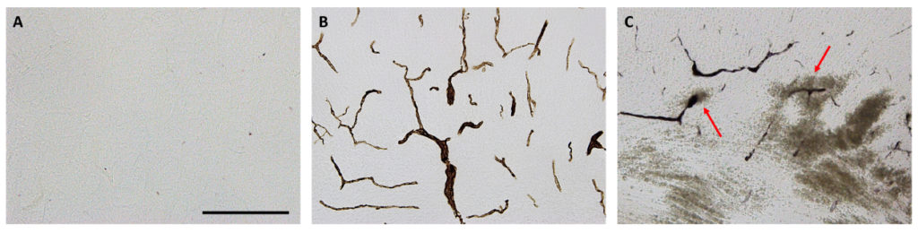 A Neonatal Rodent Model of Retroorbital Vein Injection