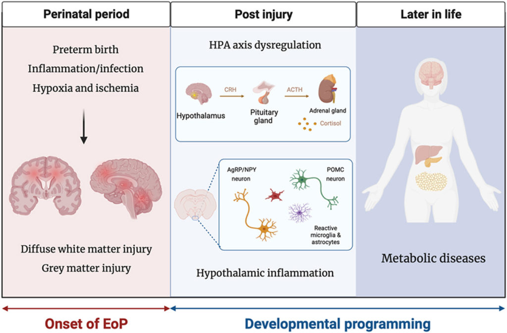 Preterm birth a neuroinflammatory origin for metabolic diseases