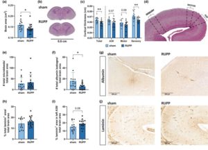 RUPP fetuses show changes in morphological brain structure at E19