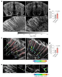 Analysis of the arteriolar architecture