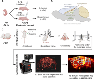 Protocol for assessment of changes in long-term functional connectivity using functional ultrasound imaging in a mouse model of IL-1β systemic perinatal inflammation