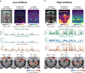 Quality control metrics reveal distinct signatures of motion artifacts